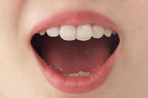 ベイザー脂肪吸引で理想のボディへ